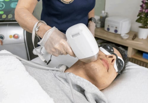 Discover Confidence with Laser Hair Reduction in Woodland Hills