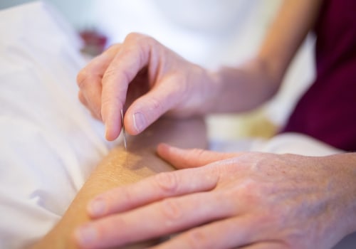 Personalized Acupuncture for Mental Wellness in Portland